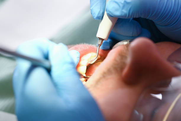 Best Urgent Dental Care in South Lancaster, MA